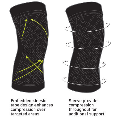 Kinetic knee sleeve by SPARK™